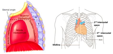 Heart – External Features – Anatomy QA