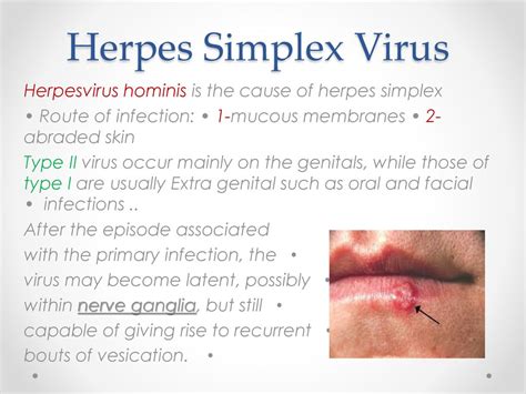 Viral infections Done by: Ruba Hiasat. - ppt download