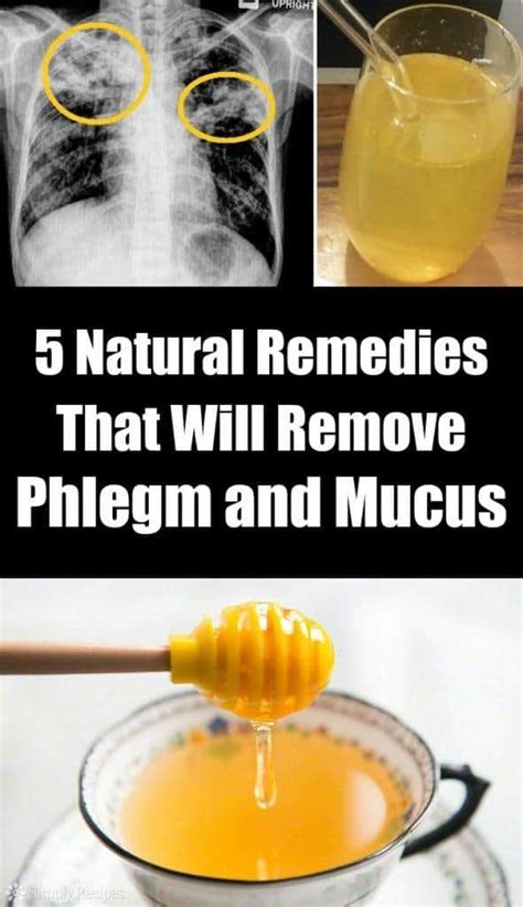 5 Natural Remedies That Will Remove Phlegm and Mucus