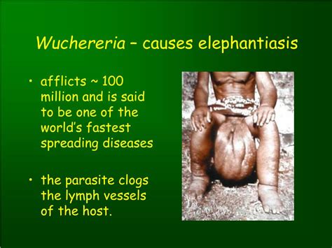 Elephantiasis Disease Causes Symptoms And Elephantiasis