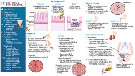 Pathology: Gastritis & Peptic Ulcer Disease | ditki medical ...