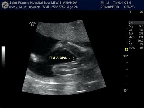 30 Weeks Pregnant Ultrasound Gender