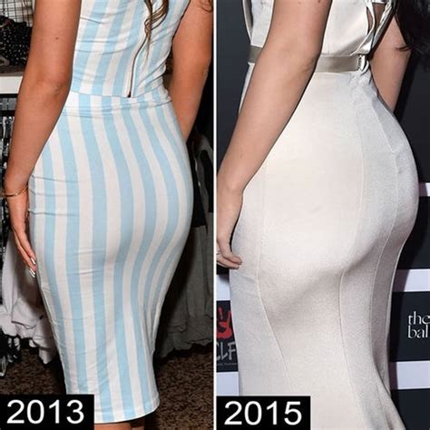 Kylie Jenner Before and After Plastic Surgery Photos Reveal Drastic ...