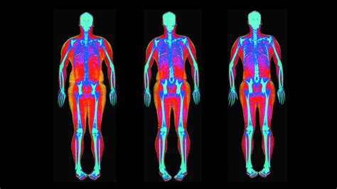 Do you need a DEXA scan? | CHOICE