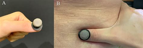 Construct validity and reliability of tests for sacroiliac dysfunction ...