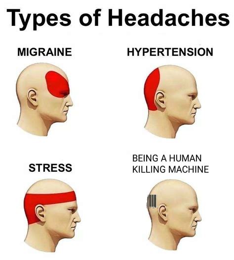 Headache Chart: What Does Headache Location Mean?