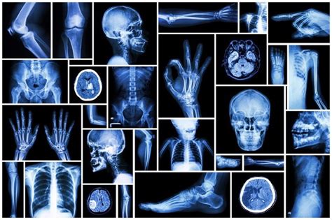 Medical X-ray Interpretation - First And Best