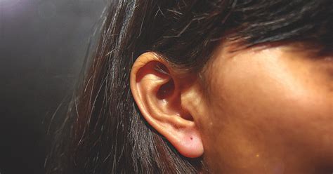 Psoriasis in the Ears: Identification, Treatment, and More