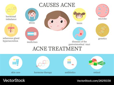 Acne Causes And Treatment Diagram Vector Flat Illustration | The Best ...