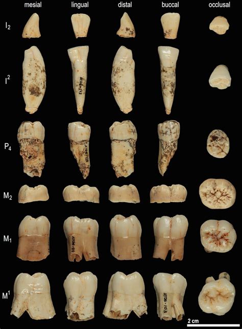 Image of the Day: Ancient Dental Enamel | The Scientist Magazine®