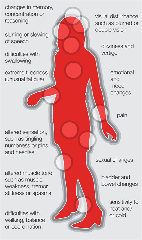 What is Multiple Sclerosis (MS)? - Prestige Employment Solutions