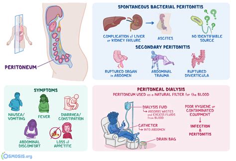 How To Cure Peritonitis - Effortbroad24