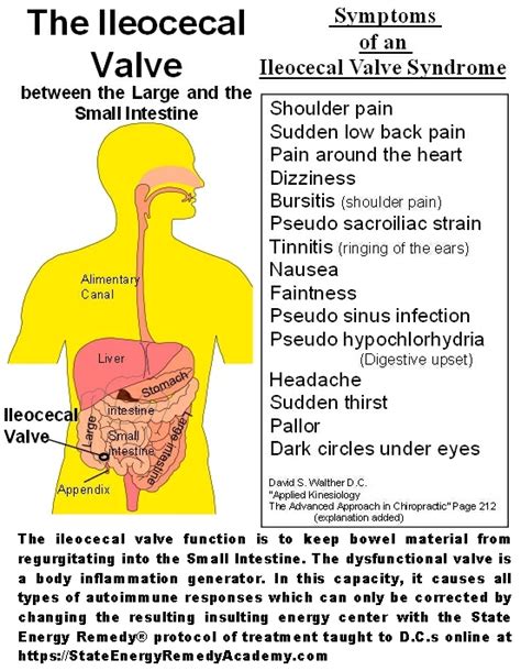 ileocecal valve