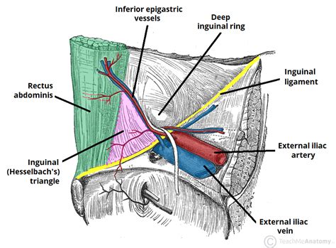 Hesselbach’s Triangle (Diagram) – Holistic Hernia Remediation