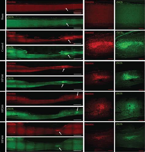 Harpagophytum procumbens (HP) ameliorates oxidative stress through ...