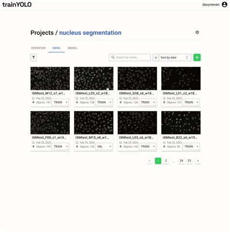 How to train YOLOv8 segmentation on a custom dataset