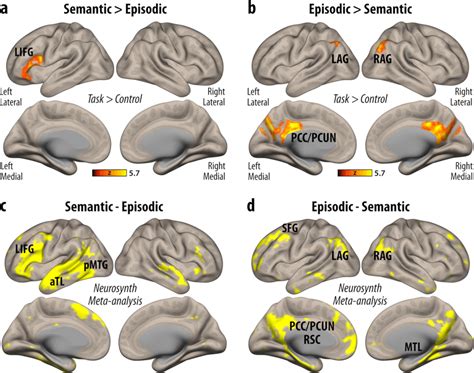 Differential brain activity patterns in the retrieval of long-term ...