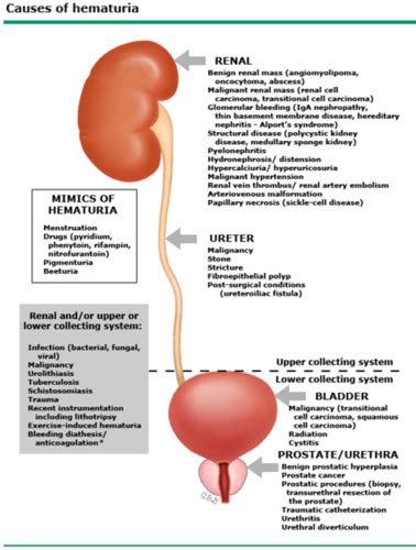 Intrinsic Renal Disease Flashcards | Quizlet