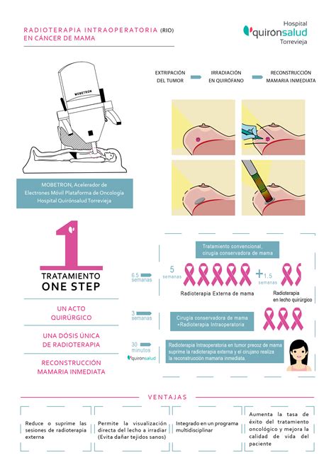 Los nuevos tratamientos para el cáncer de mama: la RIO y el ...