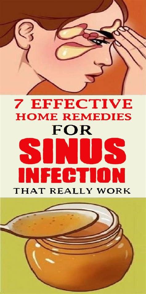 homemade medicine #NaturalDIYRemedies | Home remedies for sinus, Sinus ...