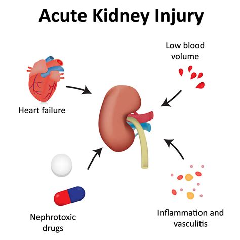 Acute kidney failure