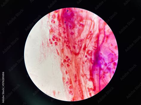 Bacteria cell in sputum sample Gram stain method. Stock Photo | Adobe Stock