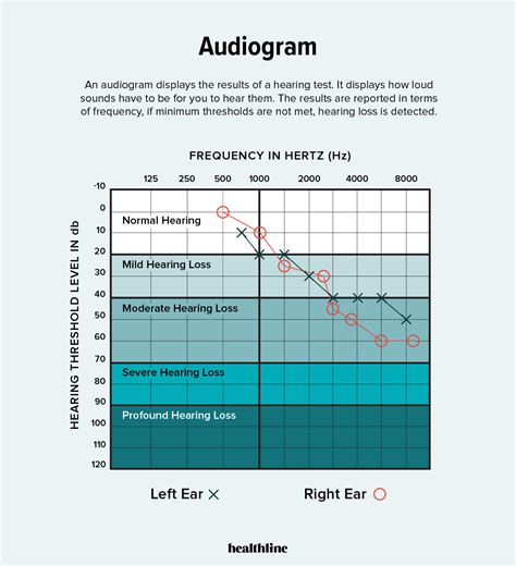 How to Read an Audiogram: Graph, Symbols, and Results Explained