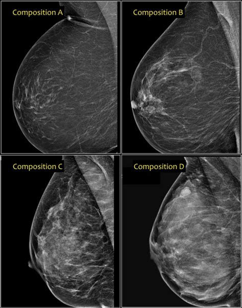 ホビー Diagnostic Imaging: Breastの通販 by あおちゃん's shop｜ラクマ エンタメ