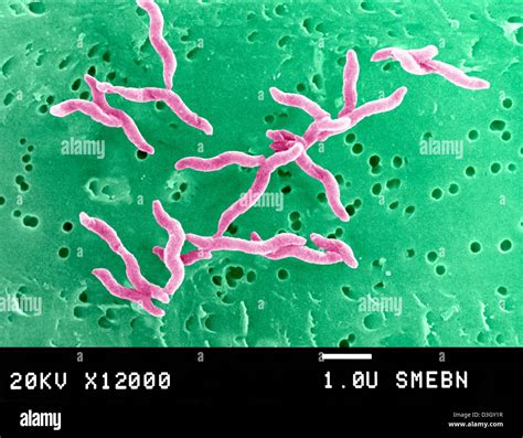 Campylobacter jejuni hi-res stock photography and images - Alamy