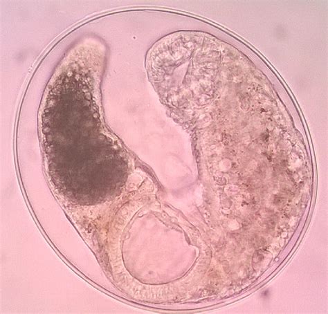 Clonorchis Sinensis Labeled