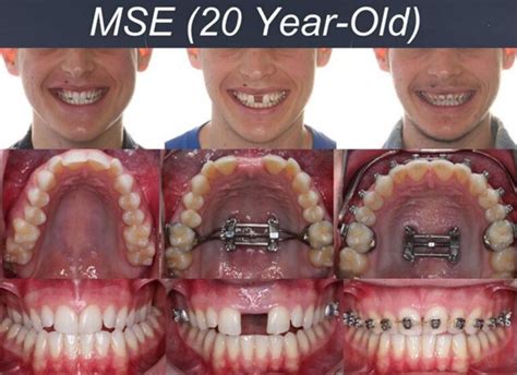 mse-02 - United dental care