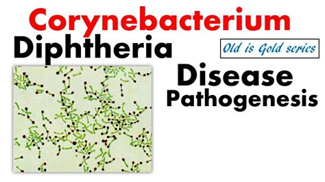 Corynebacterium diphtheriae microbiology lecture | Pathogenesis ...