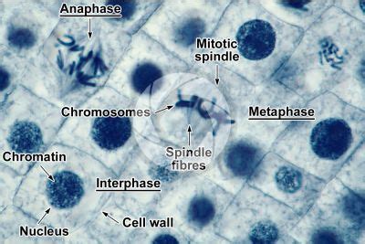 Metaphase Microscope