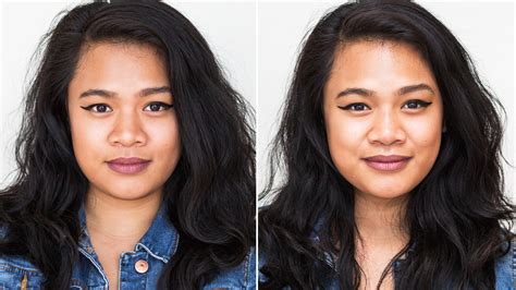 I Got a Non-Surgical Nose Job, and Here's What Happened | Allure