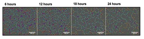 Angiogenesis explained - Araceli Biosciences