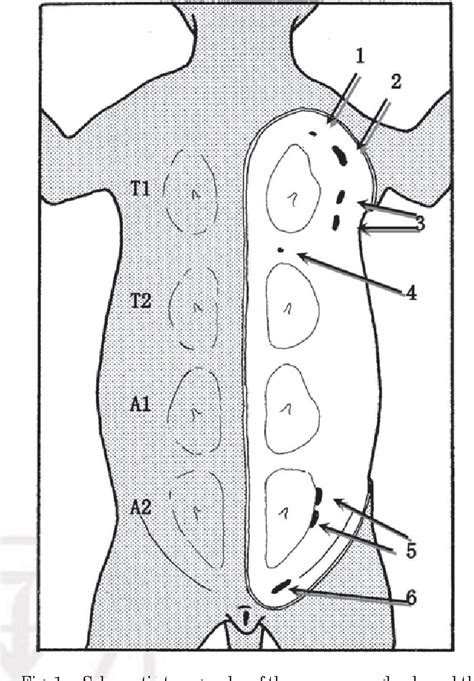 Figure 12 from Lymph drainage of the mammary glands in female cats ...