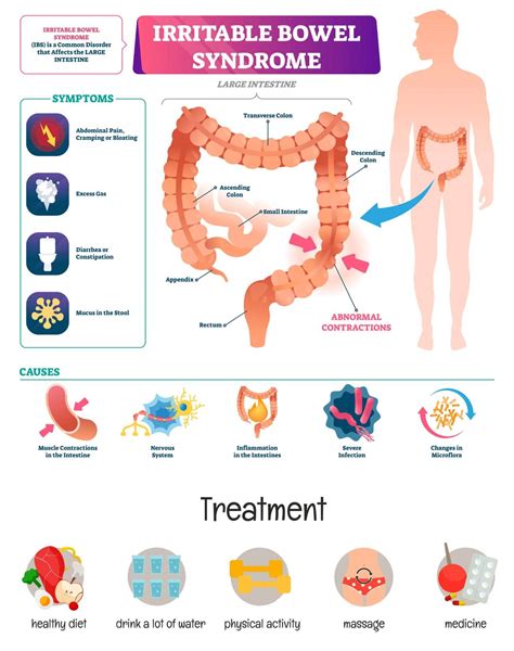 How To Ease Symptoms Of Ibs - Contestgold8