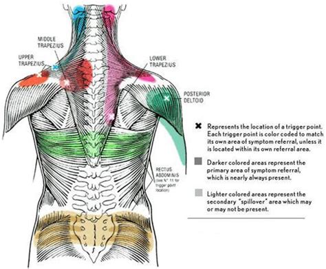 Trigger Point Charts Information