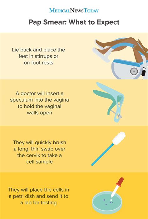 Pap Smear Procedure Steps