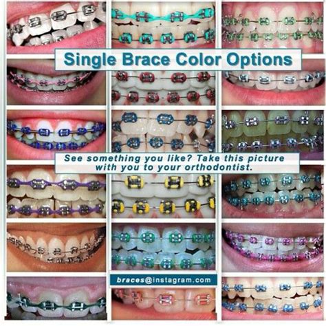 68 best images about ||Braces colors|| on Pinterest