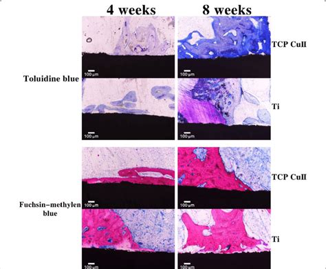 Toluidine blue and fuchsin-methylene blue staining of new bone ...