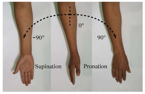 Manual Muscle Testing of the Forearm - Supination and Pronation