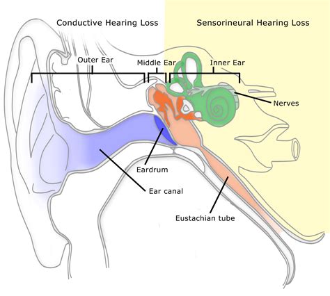 Hearing Loss, Tinnitus and Imbalance/Vertigo