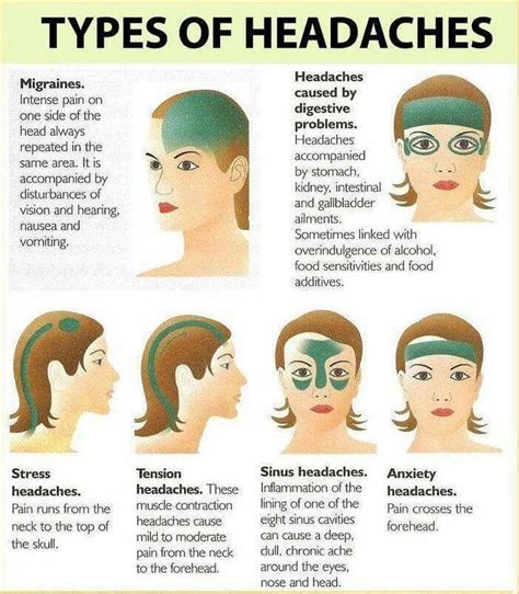 Instagram post by Medical Notes • Jul 20, 2019 at 9:27pm UTC | Headache ...