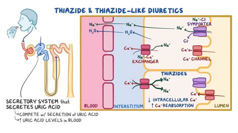 Thiazide and thiazide-like diuretics: Video & Anatomy | Osmosis