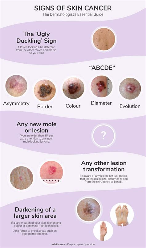 Skin Cancer Signs & Symptoms | The Dermatologist's Essential Guide