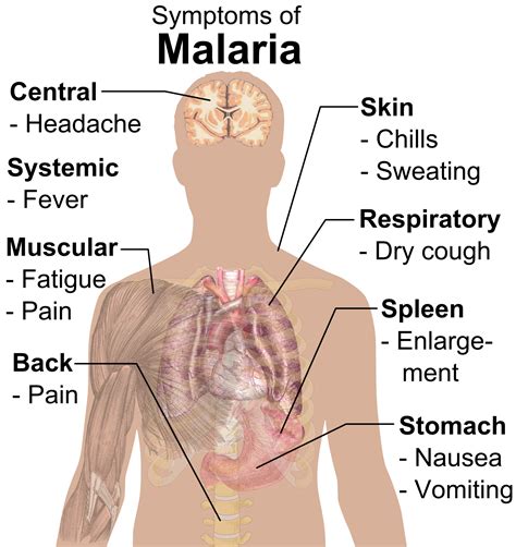 File:Symptoms of Malaria.png