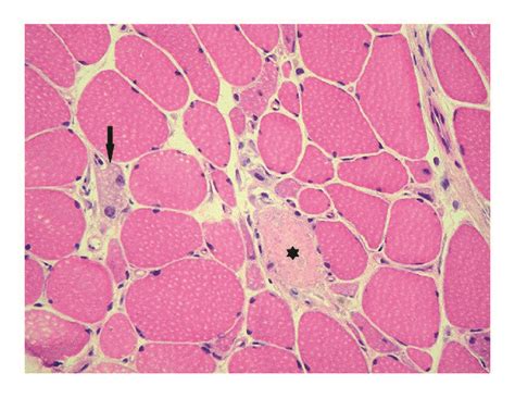 Skeletal Muscle Fiber Histology