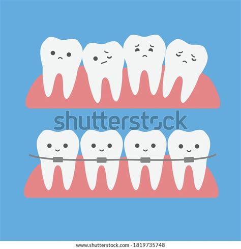 Cute Cartoon Teeth Braces Kids Vector Stock Vector (Royalty Free ...