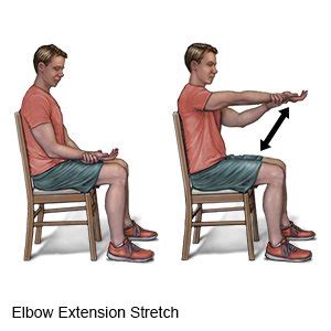 Elbow Bursitis Exercises - What You Need to Know